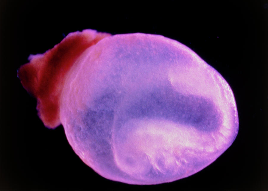 View Of A 10.2 Day Old Foetus Of A Rat Photograph by Science Photo Library View Of A 10.2 Day Old Foetus Of A Rat Photograph by Science Photo Library