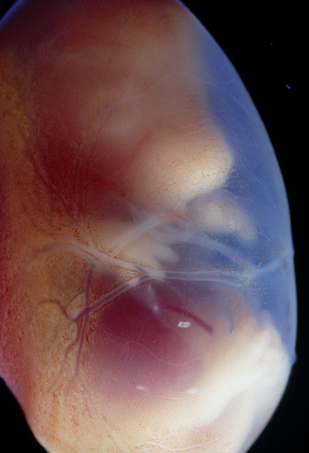 View Of A 15.5 Day Old Foetus Of A Rat Photograph by Science Photo Library View Of A 15.5 Day Old Foetus Of A Rat Photograph by Science Photo Library