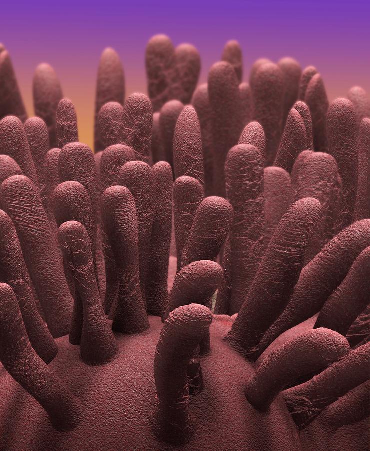Villi Photograph by Tim Vernon / Science Photo Library