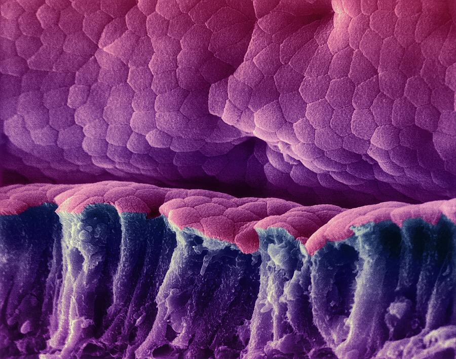 Villus Surface Of The Small Intestine Photograph by Dennis Kunkel Microscopy/science Photo Library