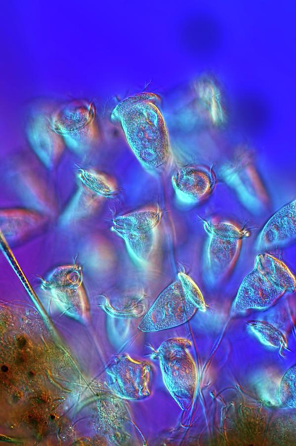 Vorticella Protozoa Photograph by Frank Fox