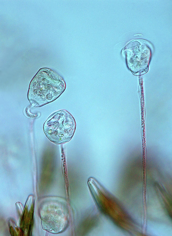 Vorticella Protozoa Photograph by Marek Mis