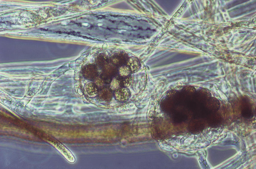 Water Mold Lm Photograph by Biology Pics