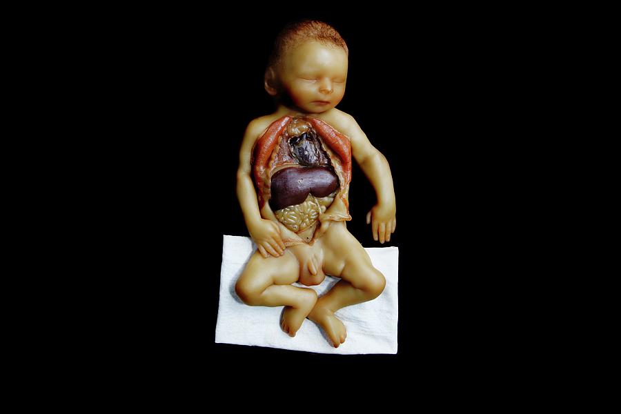 Anatomical Model Photograph - Wax Model Of A Dissected Baby by Gregory Davies