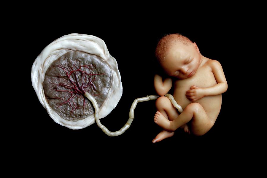 Anatomical Model Photograph - Wax Model Of A Foetus And Placenta by Gregory Davies