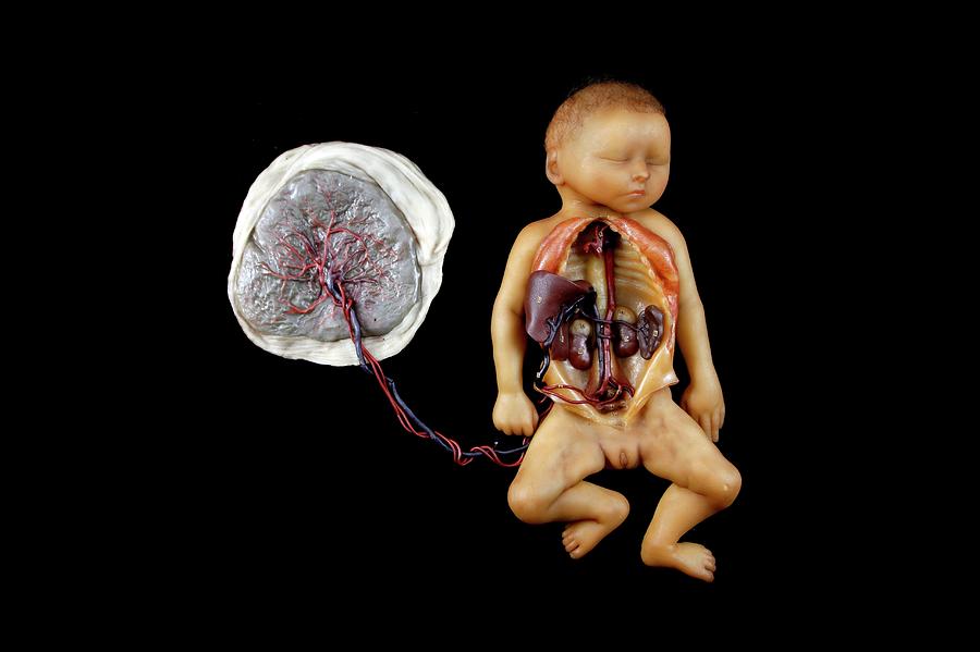 Anatomical Model Photograph - Wax Model Of Human Foetus Dissection by Gregory Davies