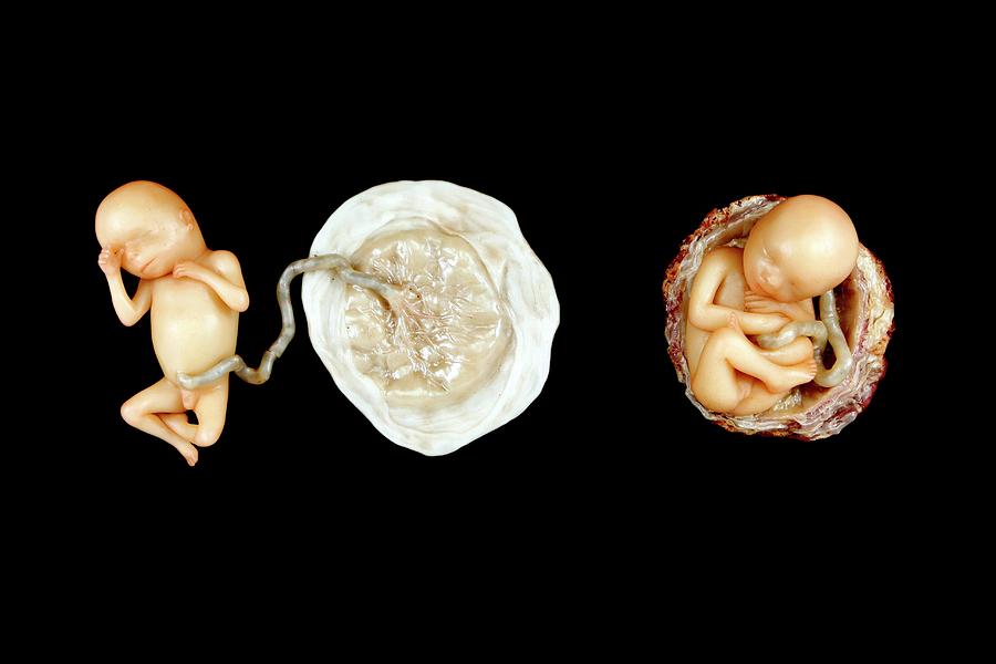 Anatomical Model Photograph - Wax Models Of Human Foetus by Gregory Davies