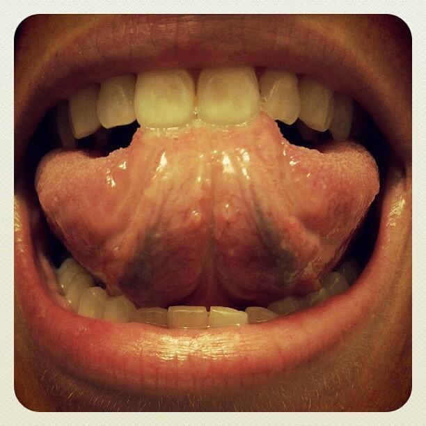 Tongue Photograph - Weird Tongue Bumps. Dont Hurt But Are by Anne Simon