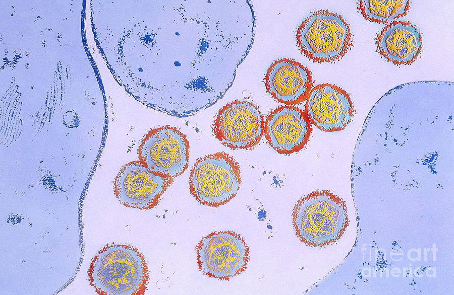 West Nile Virus Photograph by Chris Bjornberg
