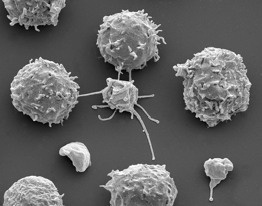White Blood Cells And Platelets Photograph By Steve Gschmeissner