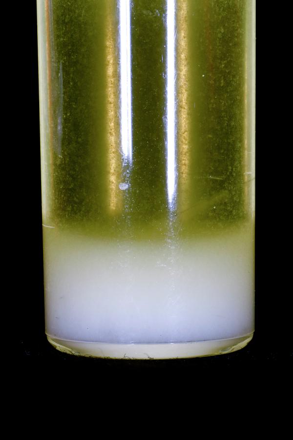 pictures of white particles in urine