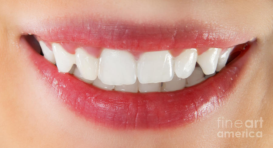 Background Photograph - White healthy teeth by Michal Bednarek