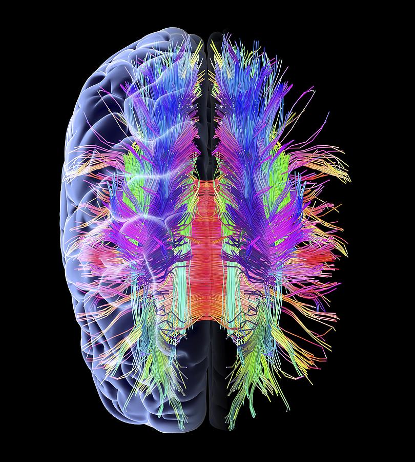 Brain Photograph - White matter fibres and brain, artwork by Science Photo Library