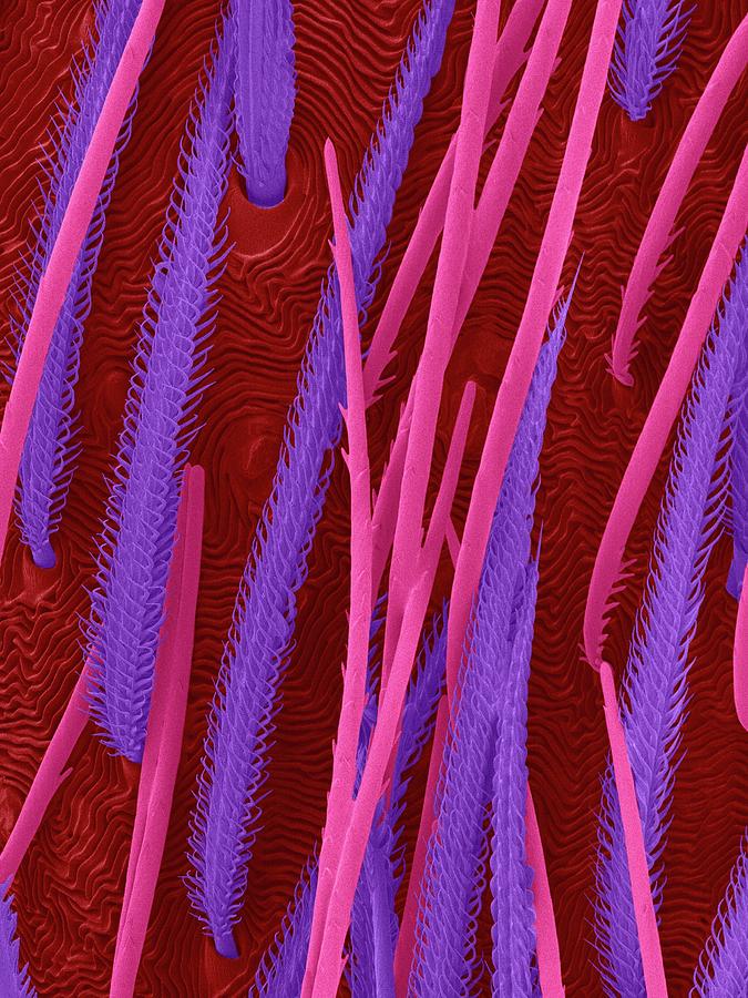 Wolf Spider Abdomen Hairs Photograph by Dennis Kunkel Microscopy/science Photo Library