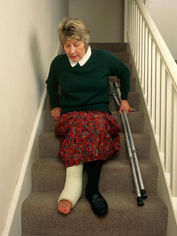 Woman With Broken Leg Descends Staircase Photograph by Simon Fraser/science Photo Library