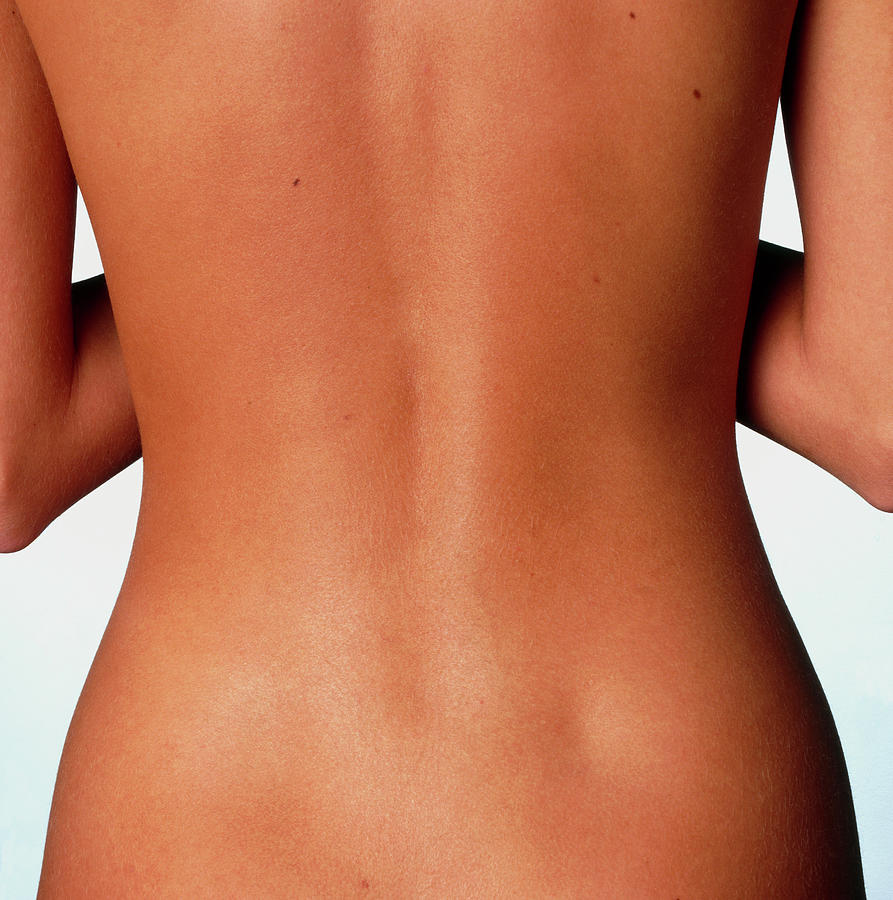 Womans Back: Posterior View Of The Torso Photograph by Phil Jude/science Photo Library