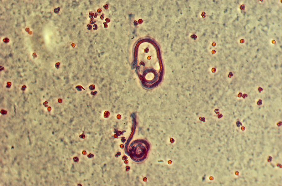 Wucheria Bancrofti, Parasite Photograph by Robert Knauft / Biology Pics