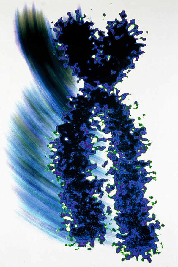 X Chromosome Photograph by Joubert