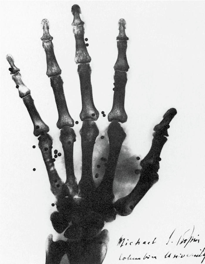 X-ray, 1896 Photograph by Granger