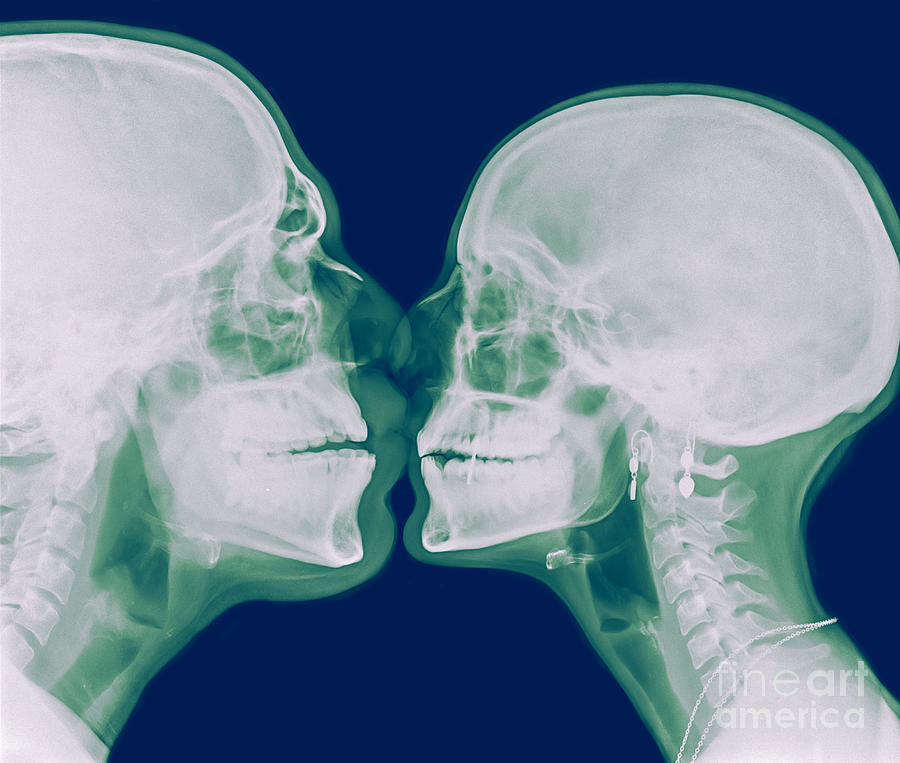 X-ray kissing Photograph by Guy Viner