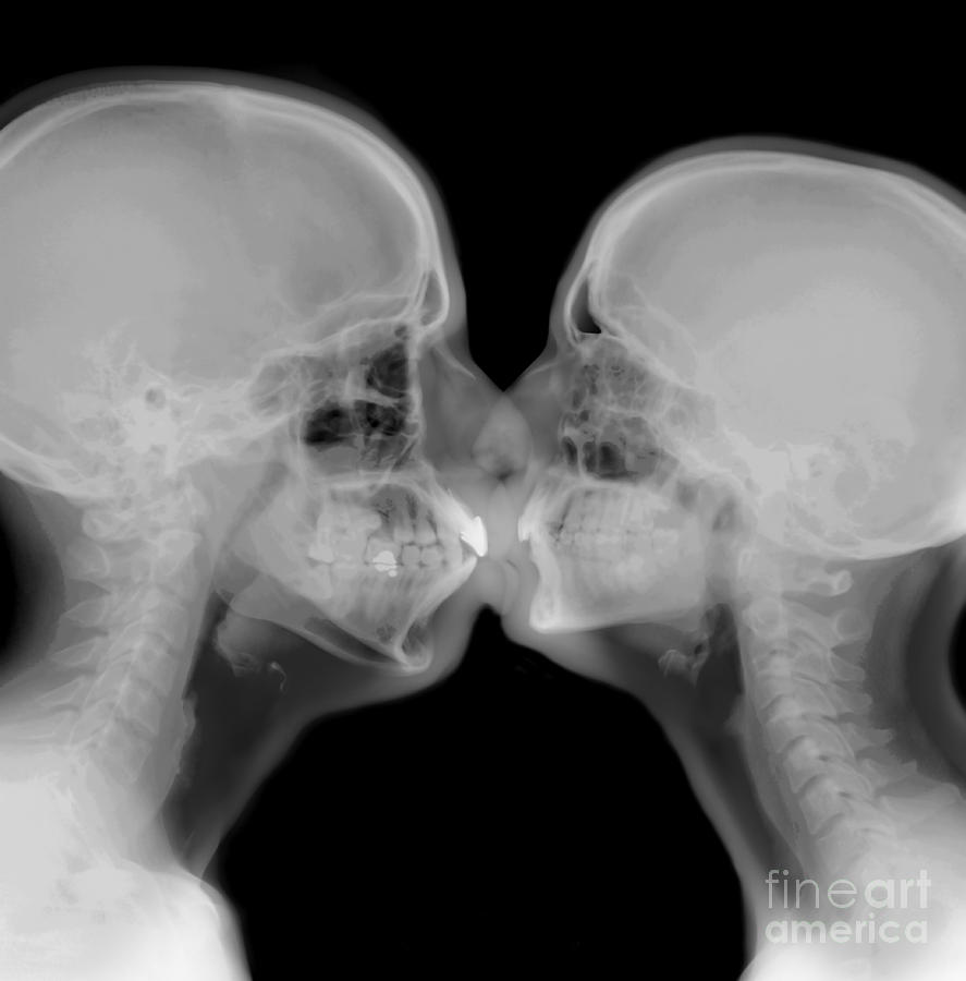 X-ray of a couple kissing Photograph by Guy Viner