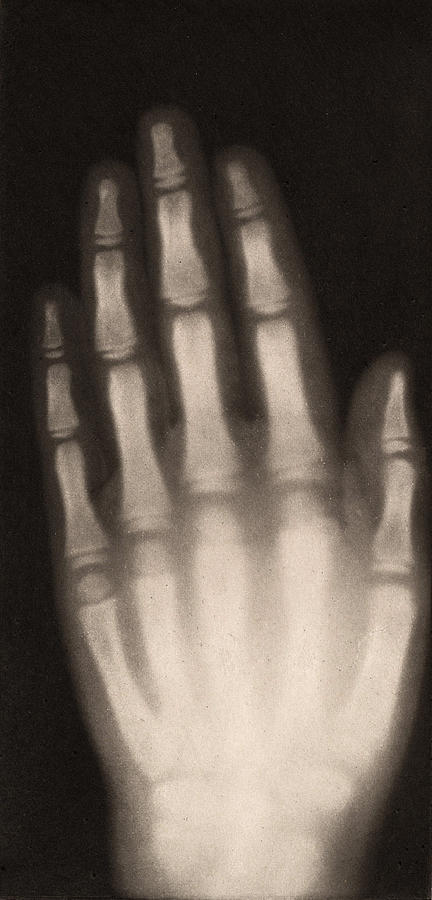 X-ray Of Girls Hand, 1896 Photograph by Metropolitan Museum of Art