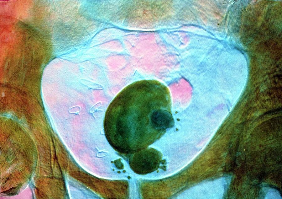 X-ray Of Human Pelvis Photograph by Alain Pol, Ism/science Photo Library