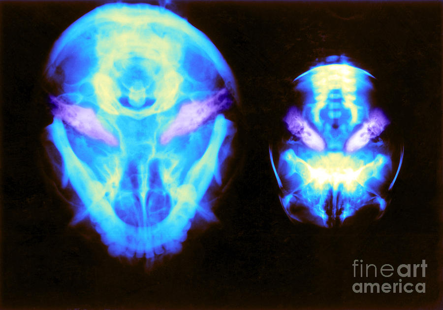 X-ray Of Inner Ear, Adult And Newborn Photograph by Biophoto Associates