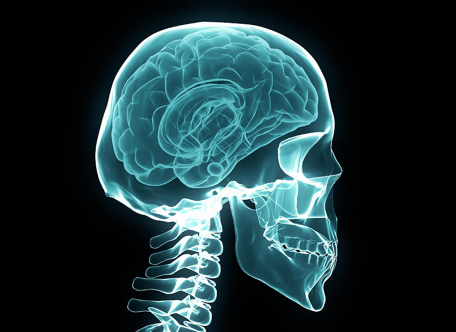 X-ray Of The Human Brain And Skull by Jesper Klausen / Science Photo Library