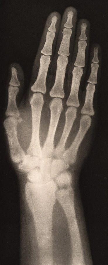 X-ray Of Womans Hand, 1896 Photograph by Metropolitan Museum of Art