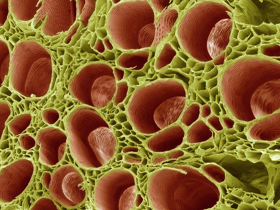 Xylem Tissue Photograph by Steve Gschmeissner