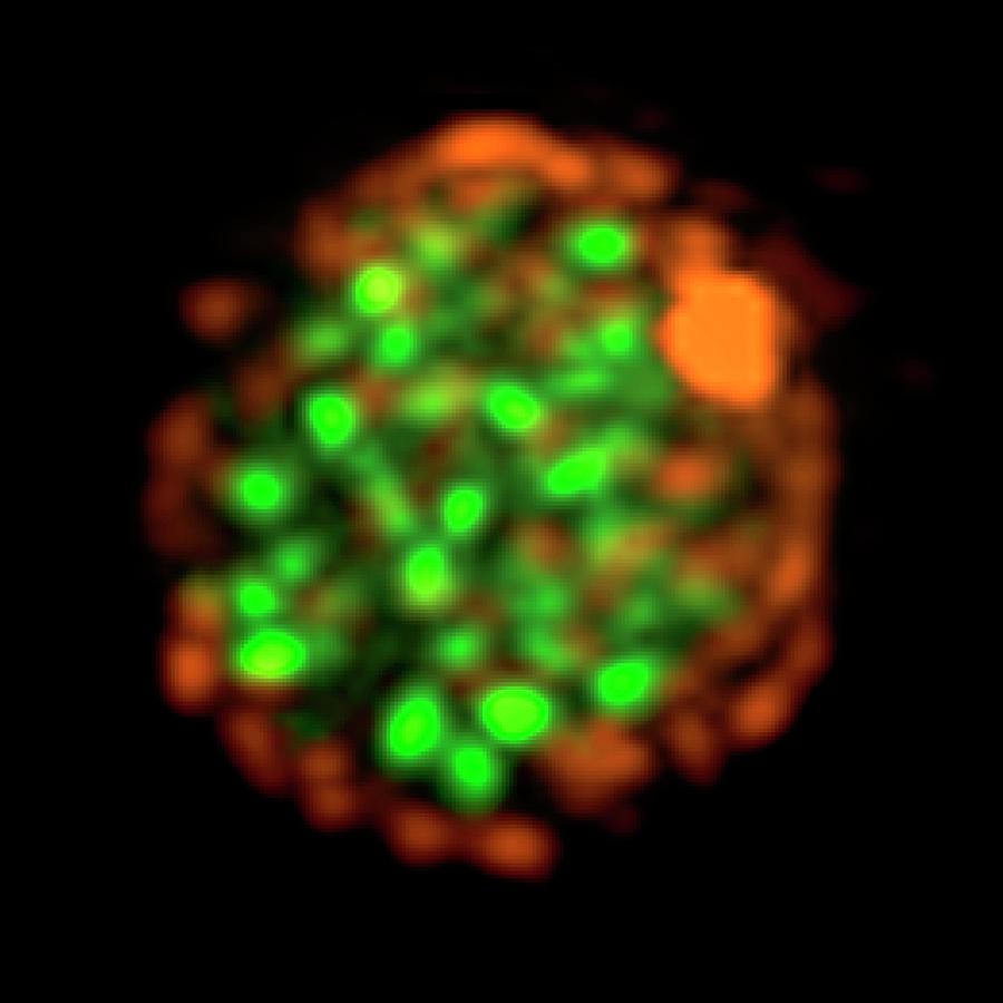 Yeast Photograph - Yeast Cell Nucleus by Dr Paul Andrews, University Of Dundee Yeast Photograph - Yeast Cell Nucleus by Dr Paul Andrews, University Of Dundee