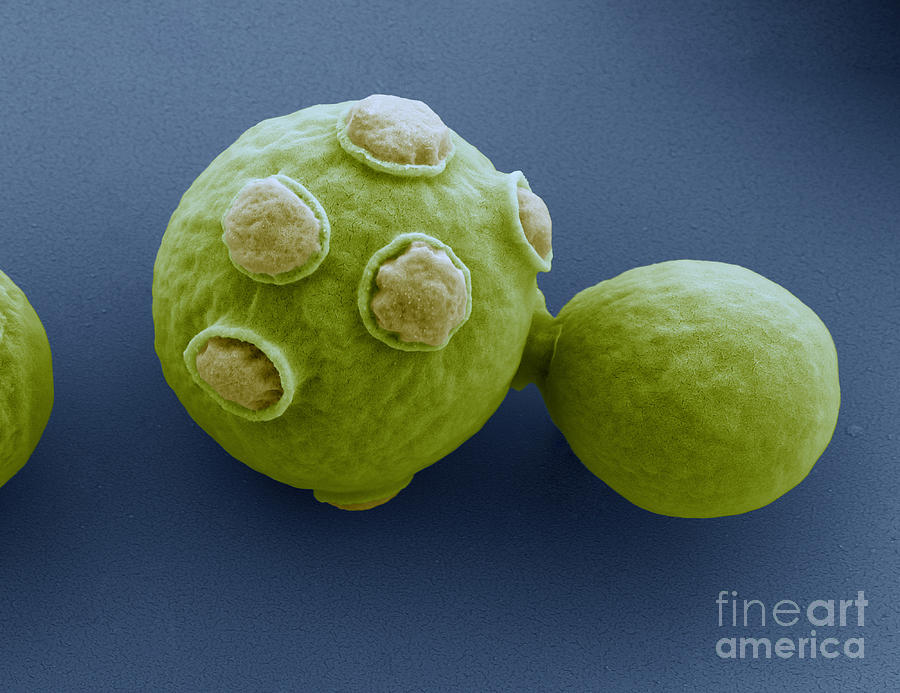 Color Photograph - Yeast Cells Sem by Eye of Science