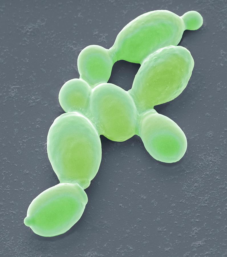 Yeast Cells Photograph by Steve Gschmeissner/science Photo Library