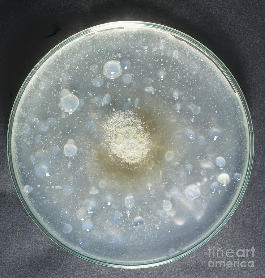 Yeast Culture In Petri Dish Photograph by Frank Greenaway / Dorling Kindersley
