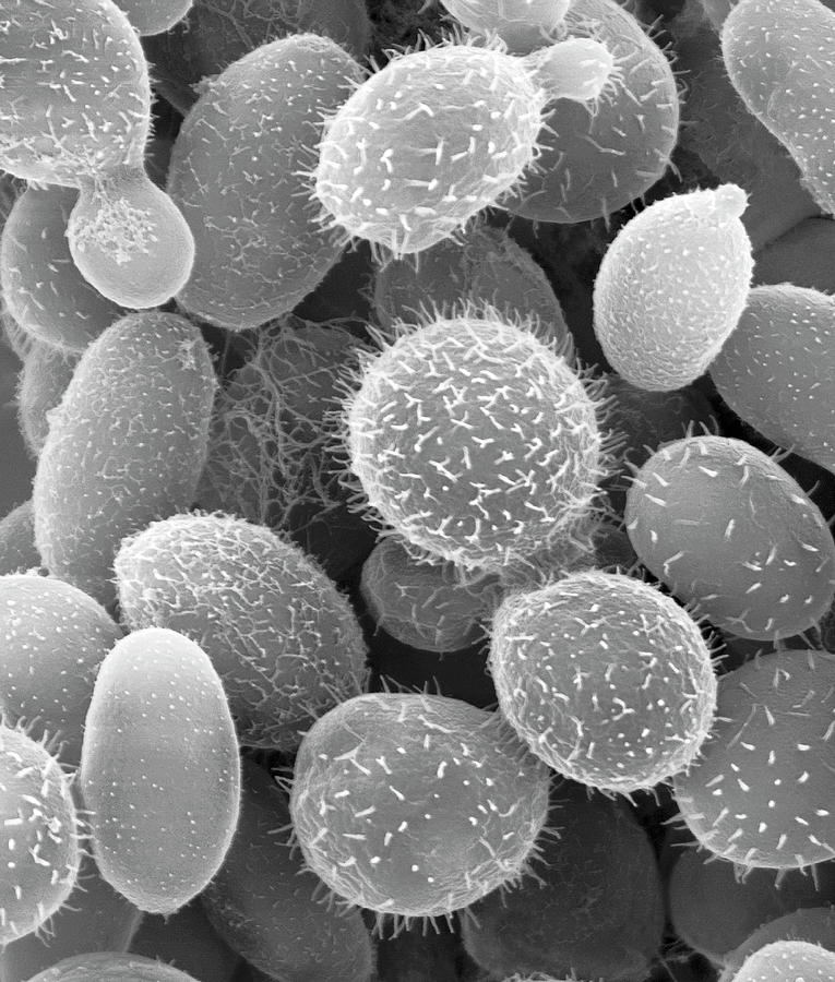Yeast Fungus Cryptococcus Festucosus Photograph By Dennis Kunkel