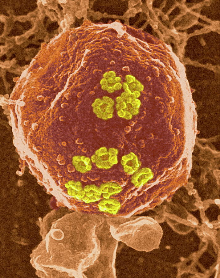 Yeast Nucleus Photograph by Dr Elena Kiseleva/science Photo Library
