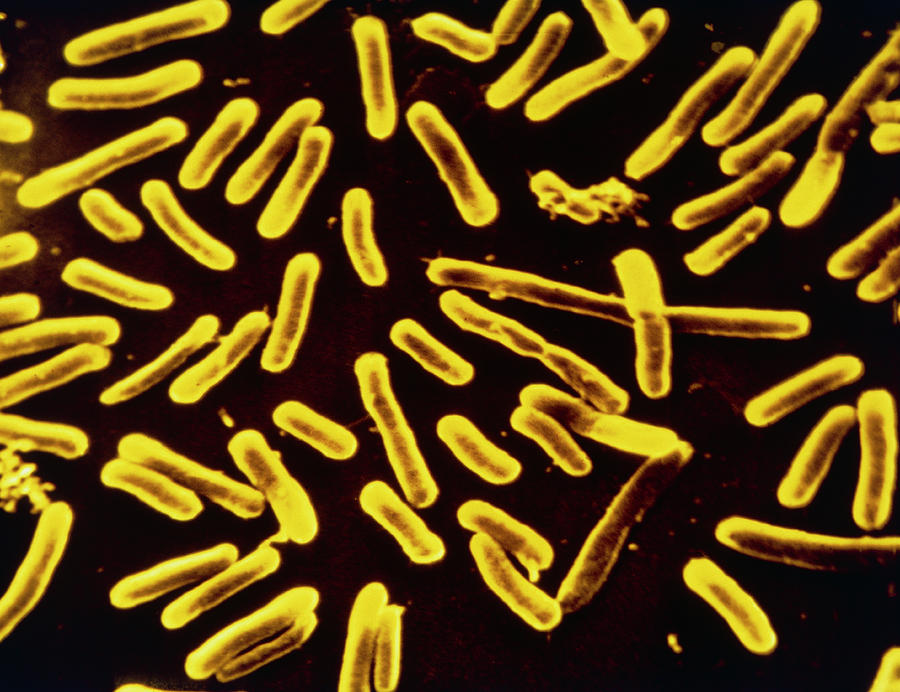 Yersinia Enterocolitica Bacteria Photograph By Cnri Science Photo Library Pixels