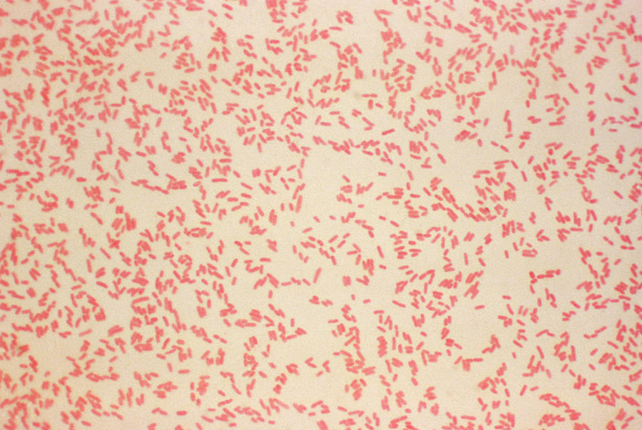 Yersinia Enterocolitica Bacteria, Lm Photograph by Science Source