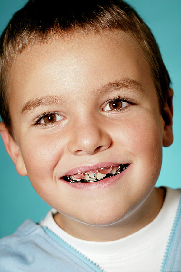Young Boy Wearing A Dental Retainer Photograph by Mauro Fermariello/science Photo Library