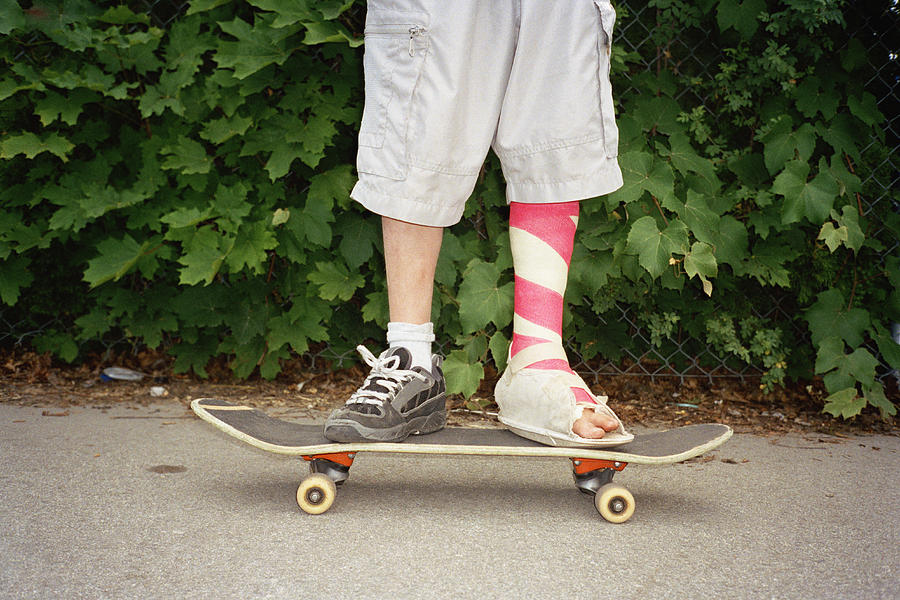 Young man with leg in plaster standing on skateboard Photograph by fStop Images - Brian Cassie