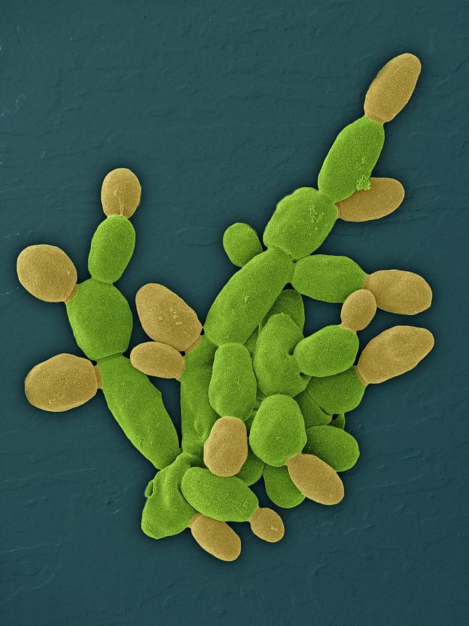 Zygosaccharomyces Bailii Yeast Photograph By Dennis Kunkel Microscopy 
