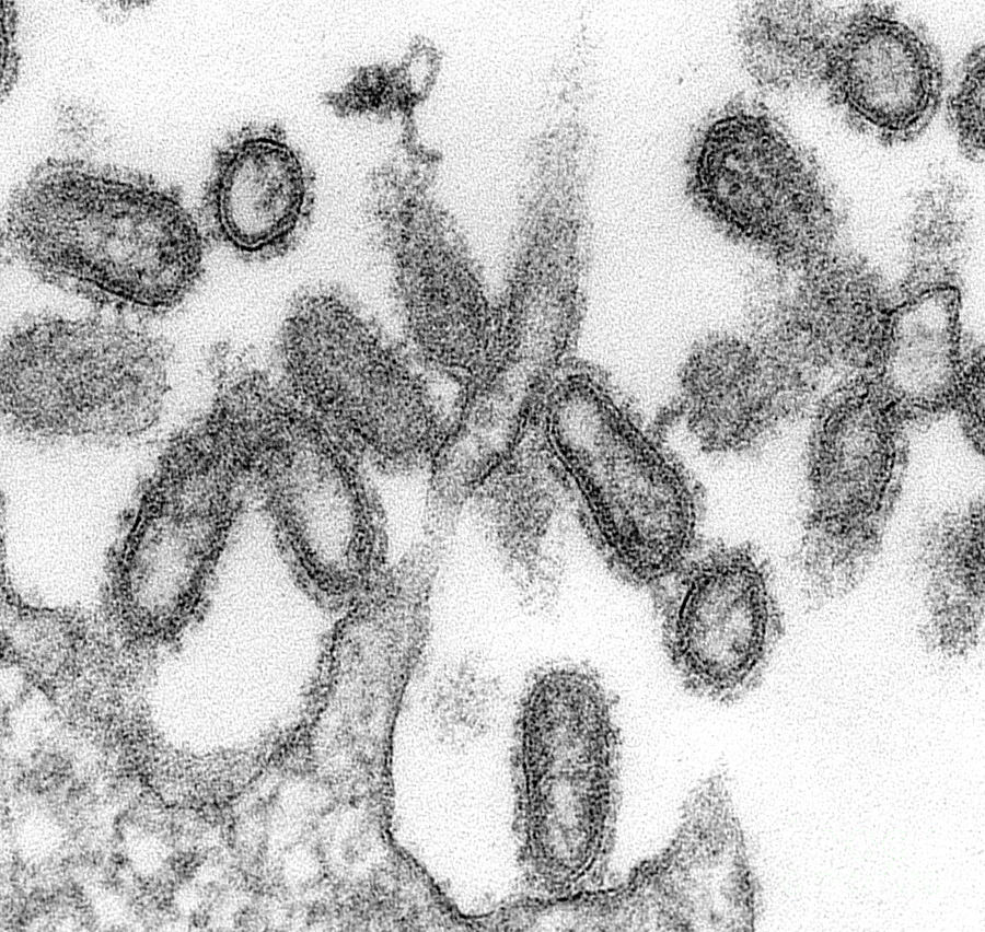 1918 Influenza Virions Photograph by Science Source