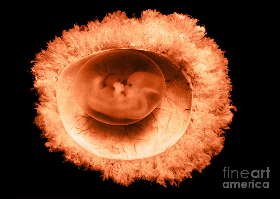 45 Day Old Human Embryo #1 Photograph by Omikron