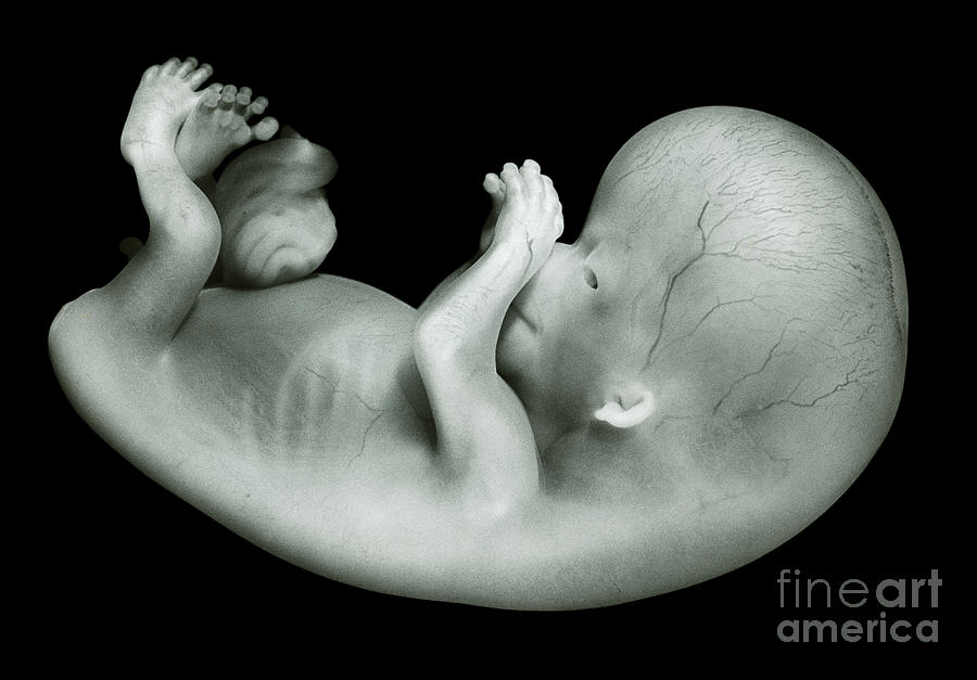 Black And White Photograph - 56 Day Old Human Fetus #1 by Omikron