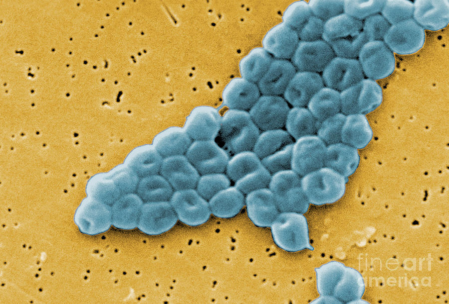 Acinetobacter Baumannii, Sem #1 Photograph by Science Source