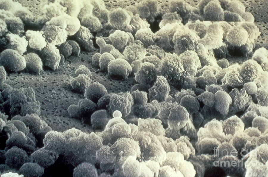 Aids Virus Sem #1 Photograph by Science Source