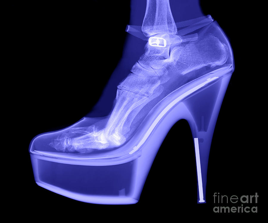 An X-ray Of A Foot In A High Heel Shoe #1 Photograph by Ted Kinsman