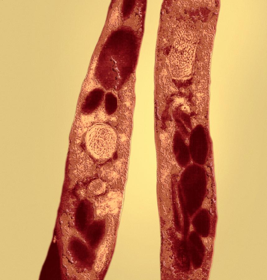 Bacillus Anthracis Photograph - Anthrax Bacteria, Tem #1 by Ami Images