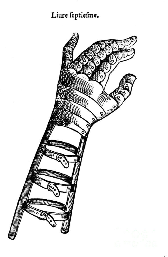 Artificial Hand Designed By Ambroise #1 Photograph by Science Source